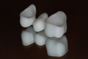 Dentalkeramik